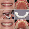 Instant Smile Veneers — Temporary Tooth Cover Kit