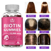Collagen Gummies — Biotin Supplement for Skin Nails and Hair