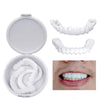 Instant Smile Veneers — Temporary Tooth Cover Kit
