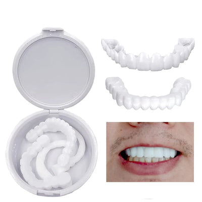 Instant Smile Veneers — Temporary Tooth Cover Kit